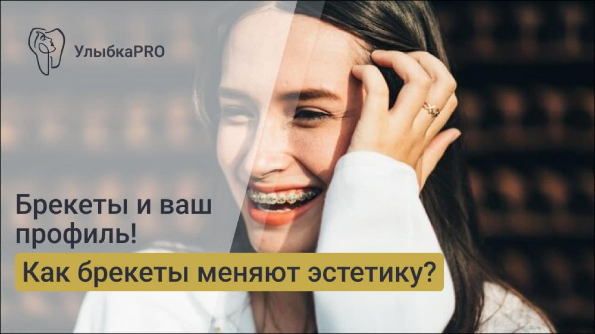Как брекеты могут изменить ваш профиль эстетика и физиология в ортодонтии