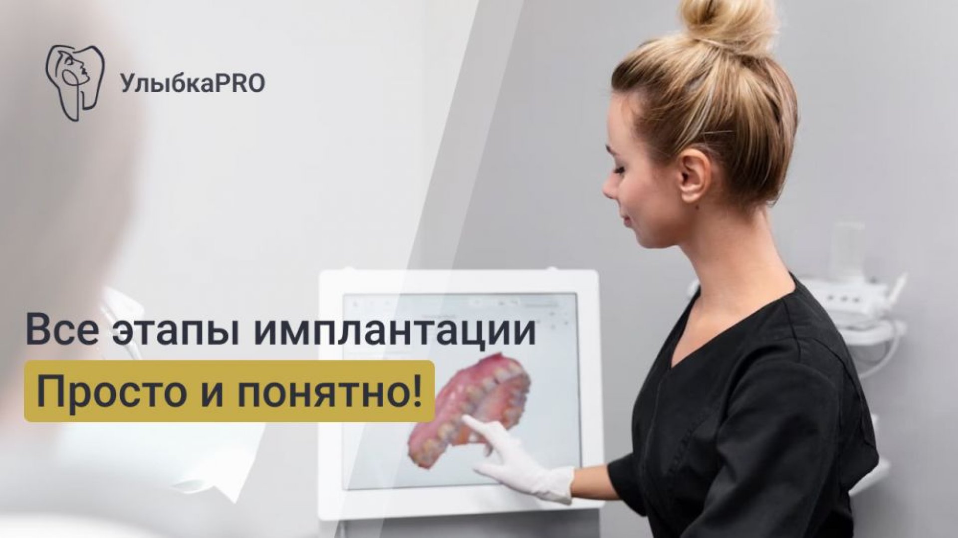 Этапы имплантации зубов пошаговое руководство для пациентов