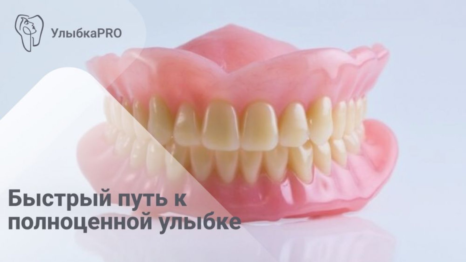 Что такое иммедиат протез и в чем его преимущества