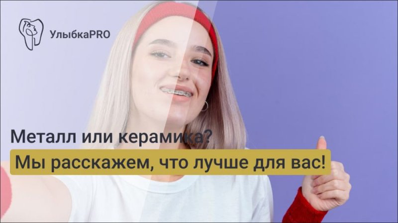 Керамические и металлические брекеты: отличия