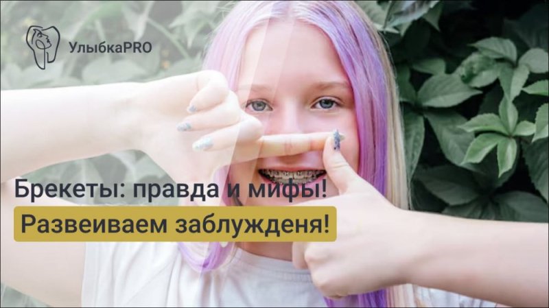 Брекеты: мифы и реальность. Развенчиваем заблуждения о лечении