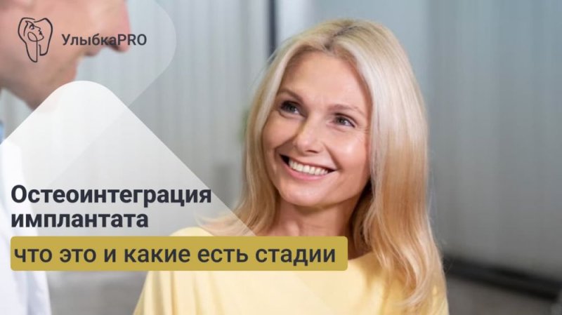Остеоинтеграция имплантата: что это и как проходит процесс?