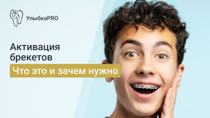Элайнеры или брекеты: что выбрать?