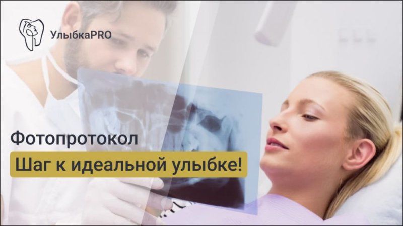 Фотопротокол для ортопедии: пошаговый процесс съемки до и после протезирования