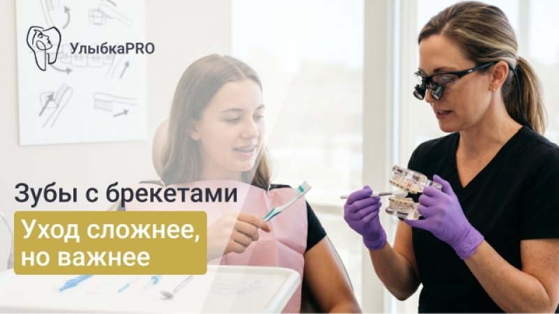 Как чистить зубы с брекетами: правильная гигиена и ошибки ухода