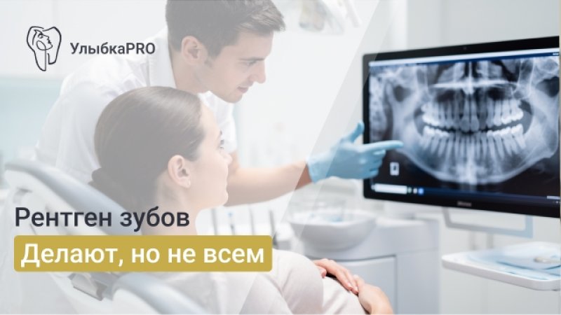Можно ли делать рентген зуба при беременности: когда это безопасно, а когда нет